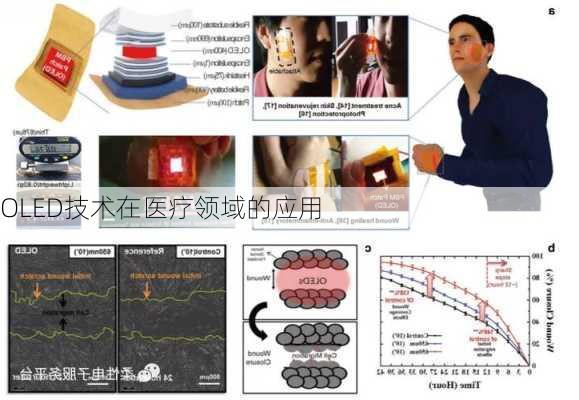 OLED技术在医疗领域的应用