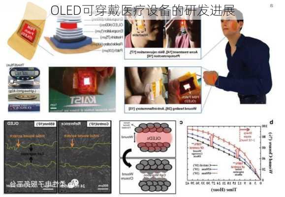 OLED可穿戴医疗设备的研发进展