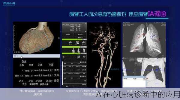 AI在心脏病诊断中的应用