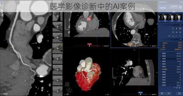 医学影像诊断中的AI案例