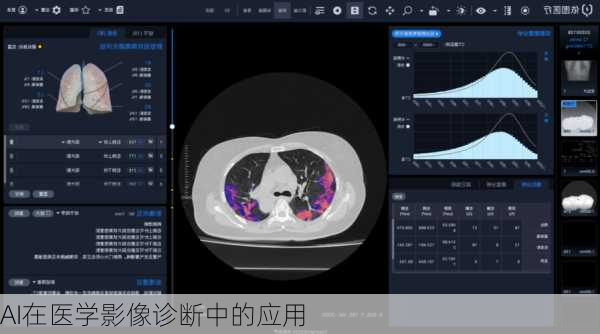 AI在医学影像诊断中的应用