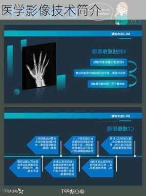 医学影像技术简介