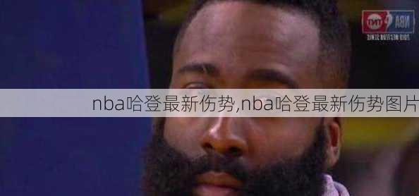 nba哈登最新伤势,nba哈登最新伤势图片